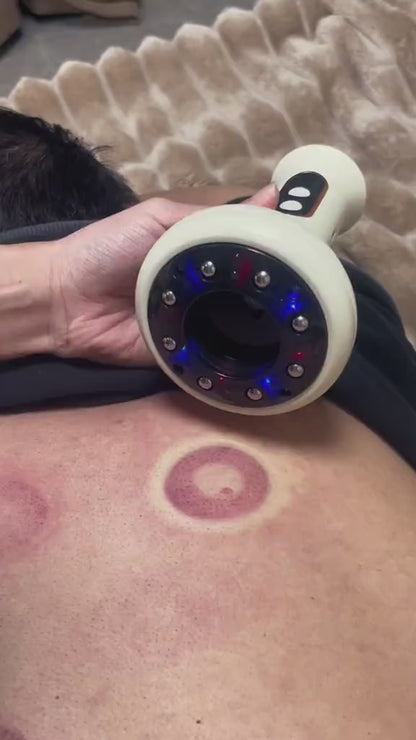 CuppaGlow™ Pro Smart Vacuum Cupping Massager